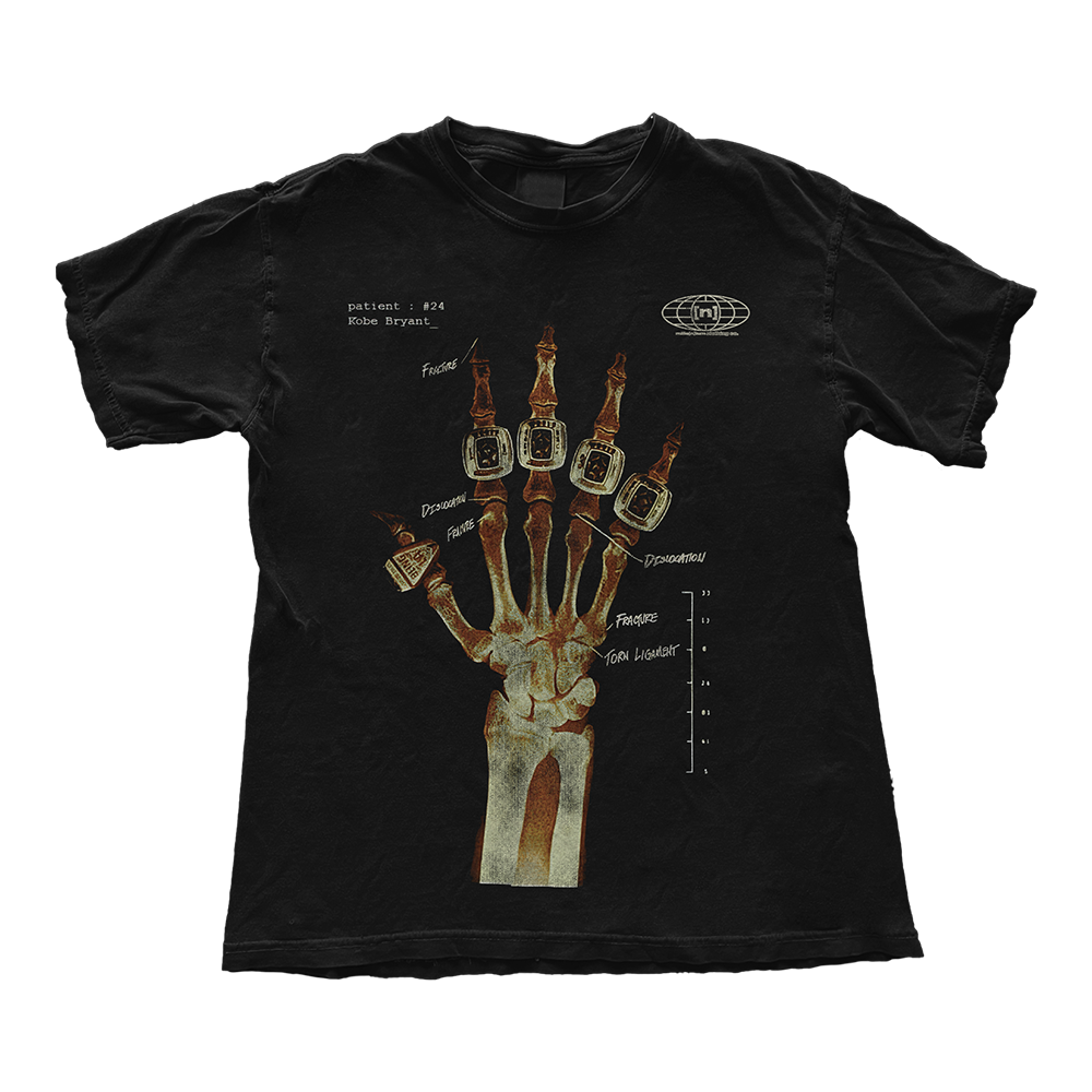Kobe Bryant Hand X Ray