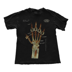 Kobe Bryant Hand X Ray