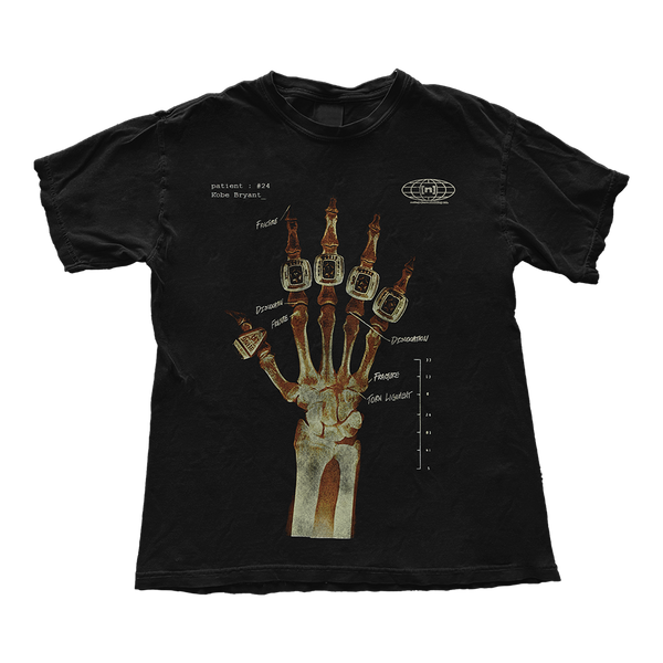 Kobe Bryant Hand X Ray