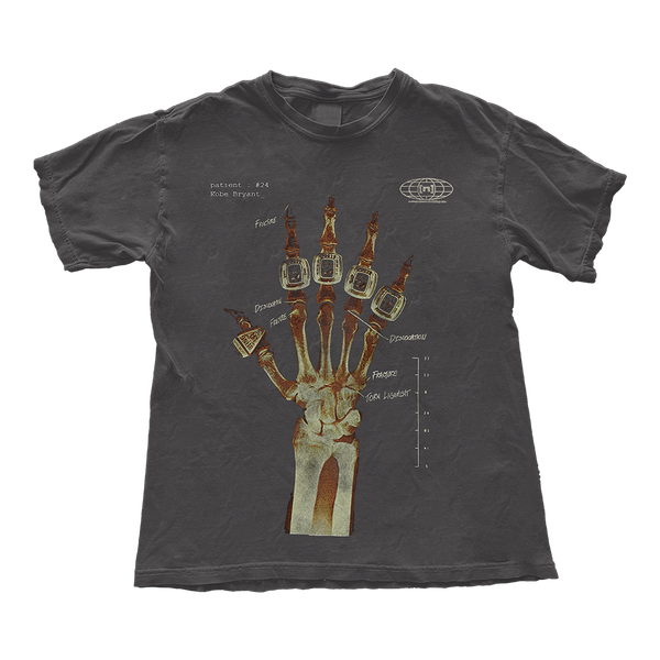 Kobe Bryant Hand X Ray