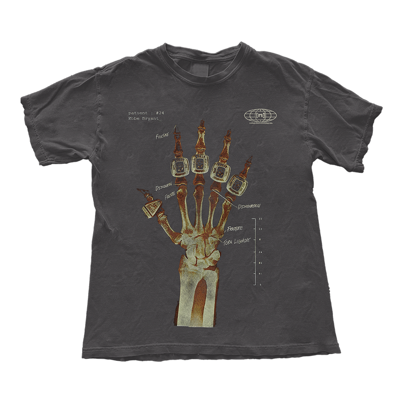 Kobe Bryant Hand X Ray